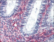 Anti-AGTR2 antibody produced in rabbit affinity isolated antibody