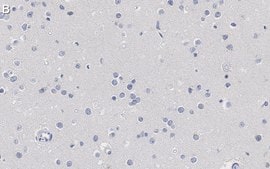 Anti-Nuclei Antibody, clone 3E1.3 ZooMAb® Mouse Monoclonal recombinant, expressed in HEK 293 cells