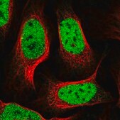 Anti-R3HCC1L antibody produced in rabbit Prestige Antibodies® Powered by Atlas Antibodies, affinity isolated antibody, buffered aqueous glycerol solution