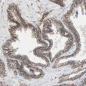 Anti-TPBG antibody produced in rabbit Prestige Antibodies® Powered by Atlas Antibodies, affinity isolated antibody, buffered aqueous glycerol solution