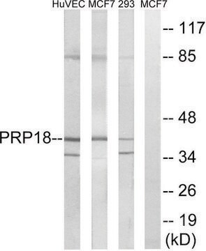Anti-PRPF18 antibody produced in rabbit affinity isolated antibody