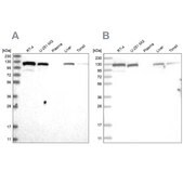 Anti-RAI14 antibody produced in rabbit Prestige Antibodies® Powered by Atlas Antibodies, affinity isolated antibody, buffered aqueous glycerol solution