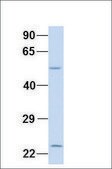 Anti-XK (ab2) antibody produced in rabbit affinity isolated antibody