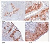 Anti-Desmoglein-1 Antibody, clone 32-2B clone 32-2B, from mouse