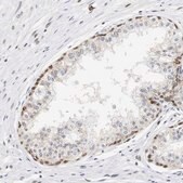 Anti-ZFC3H1 antibody produced in rabbit Prestige Antibodies&#174; Powered by Atlas Antibodies, affinity isolated antibody, buffered aqueous glycerol solution