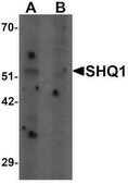 Anti-SHQ1 antibody produced in rabbit affinity isolated antibody, buffered aqueous solution