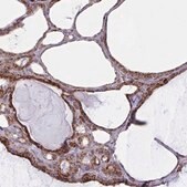 Anti-MINOS1 antibody produced in rabbit Prestige Antibodies&#174; Powered by Atlas Antibodies, affinity isolated antibody, buffered aqueous glycerol solution