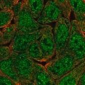 Anti-KHNYN antibody produced in rabbit Prestige Antibodies® Powered by Atlas Antibodies, affinity isolated antibody, buffered aqueous glycerol solution