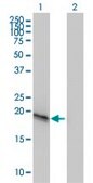Monoclonal Anti-C20orf102 antibody produced in mouse clone 3B9, purified immunoglobulin, buffered aqueous solution