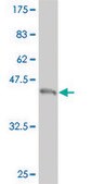 ANTI-TEK antibody produced in mouse clone 2G3, purified immunoglobulin, buffered aqueous solution