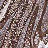 Anti-HAUS1 antibody produced in rabbit Prestige Antibodies® Powered by Atlas Antibodies, affinity isolated antibody, buffered aqueous glycerol solution