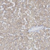 Anti-SLAMF9 antibody produced in rabbit Prestige Antibodies® Powered by Atlas Antibodies, affinity isolated antibody, buffered aqueous glycerol solution