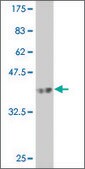 Monoclonal Anti-RIPK5 antibody produced in mouse clone 4B3, purified immunoglobulin, buffered aqueous solution