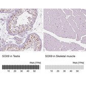 抗-SOX9 兔抗 Prestige Antibodies® Powered by Atlas Antibodies, affinity isolated antibody, buffered aqueous glycerol solution