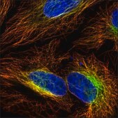 Anti-VPS13C antibody produced in rabbit Prestige Antibodies® Powered by Atlas Antibodies, affinity isolated antibody, buffered aqueous glycerol solution