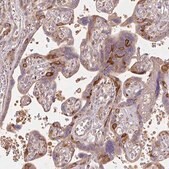 Anti-RASA1 antibody produced in rabbit Prestige Antibodies&#174; Powered by Atlas Antibodies, affinity isolated antibody