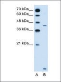 Anti-SLC46A3 antibody produced in rabbit IgG fraction of antiserum