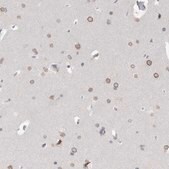 Anti-ZNF770 antibody produced in rabbit Prestige Antibodies® Powered by Atlas Antibodies, affinity isolated antibody, buffered aqueous glycerol solution