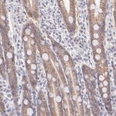 Anti-PBDC1 antibody produced in rabbit Prestige Antibodies&#174; Powered by Atlas Antibodies, affinity isolated antibody, buffered aqueous glycerol solution