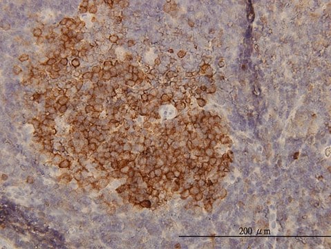 Monoclonal Anti-PHGDH antibody produced in mouse clone 4A3-1D6, purified immunoglobulin, buffered aqueous solution