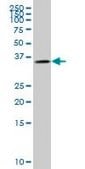 Monoclonal Anti-GYG1, (N-terminal) antibody produced in mouse clone 2C10, purified immunoglobulin, buffered aqueous solution