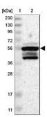 Anti-ZNF200 antibody produced in rabbit Prestige Antibodies&#174; Powered by Atlas Antibodies, affinity isolated antibody, buffered aqueous glycerol solution