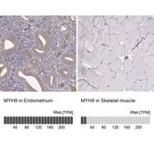 Anti-MYH9 Prestige Antibodies® Powered by Atlas Antibodies, affinity isolated antibody
