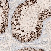 Anti-SAMD15 antibody produced in rabbit Prestige Antibodies&#174; Powered by Atlas Antibodies, affinity isolated antibody, buffered aqueous glycerol solution, ab1