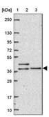 Anti-DYNC2LI1 antibody produced in rabbit Prestige Antibodies&#174; Powered by Atlas Antibodies, affinity isolated antibody, buffered aqueous glycerol solution