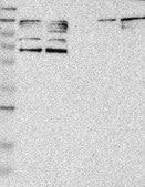 Anti-PARP3 antibody produced in rabbit Prestige Antibodies&#174; Powered by Atlas Antibodies, affinity isolated antibody, buffered aqueous glycerol solution