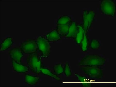 Monoclonal Anti-LGALS1 antibody produced in mouse clone 1E8-1B2, purified immunoglobulin, buffered aqueous solution