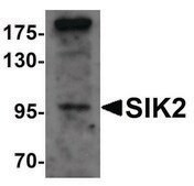 Anti-SIK2 antibody produced in rabbit affinity isolated antibody