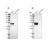 Anti-KRT23 antibody produced in rabbit Prestige Antibodies® Powered by Atlas Antibodies, affinity isolated antibody, buffered aqueous glycerol solution