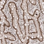 Anti-SKIV2L2 antibody produced in rabbit Prestige Antibodies&#174; Powered by Atlas Antibodies, affinity isolated antibody, buffered aqueous glycerol solution