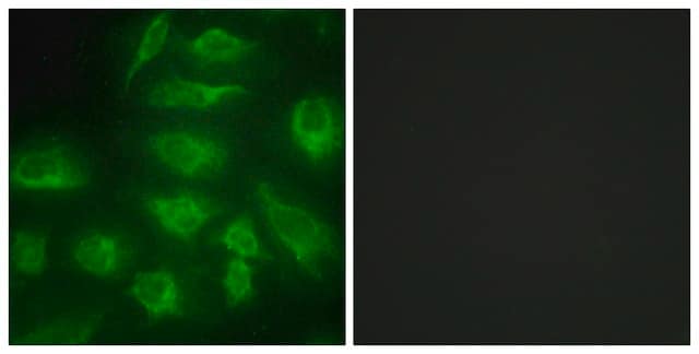 Anti-DGKI antibody produced in rabbit affinity isolated antibody