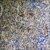 Anti-phospho-MDM2 (pSer186+Ser188) antibody produced in rabbit affinity isolated antibody