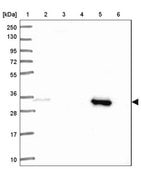 Anti-SULT1A2 antibody produced in rabbit Prestige Antibodies&#174; Powered by Atlas Antibodies, affinity isolated antibody, buffered aqueous glycerol solution