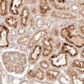 Anti-SARM1 antibody produced in rabbit Prestige Antibodies® Powered by Atlas Antibodies, affinity isolated antibody, buffered aqueous glycerol solution, Ab2