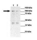 Anti-STARD8 antibody produced in rabbit affinity isolated antibody