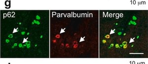 Anti-Parvalbumin Antibody ascites fluid, clone PARV-19, Chemicon&#174;