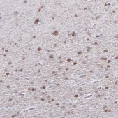 Anti-QDPR antibody produced in rabbit Prestige Antibodies&#174; Powered by Atlas Antibodies, affinity isolated antibody, buffered aqueous glycerol solution