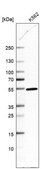 Anti-DDI2 antibody produced in rabbit Prestige Antibodies® Powered by Atlas Antibodies, affinity isolated antibody, buffered aqueous glycerol solution