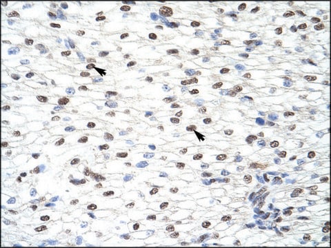 Anti-CUGBP2 antibody produced in rabbit IgG fraction of antiserum