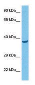 Anti-IL3RA (C-terminal) antibody produced in rabbit affinity isolated antibody