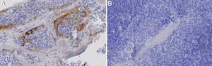 Anti-S1PR2 Antibody, clone 1C18 ZooMAb® Rabbit Monoclonal recombinant, expressed in HEK 293 cells
