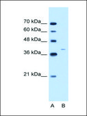 Anti-KRT13 antibody produced in rabbit IgG fraction of antiserum