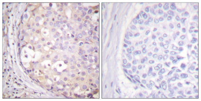 Anti-PKC-PAN antibody produced in rabbit affinity isolated antibody