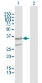 Anti-ABHD11 antibody produced in mouse purified immunoglobulin, buffered aqueous solution