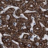 Anti-HIBADH antibody produced in rabbit Prestige Antibodies&#174; Powered by Atlas Antibodies, affinity isolated antibody, buffered aqueous glycerol solution, Ab2