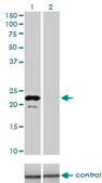 Monoclonal Anti-APOM antibody produced in mouse clone 1F10, purified immunoglobulin, buffered aqueous solution